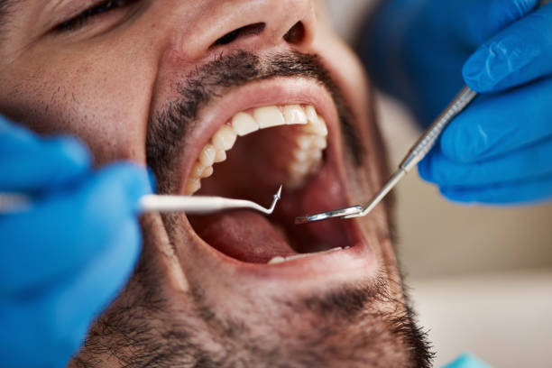 Best Emergency Dental Care for Broken or Chipped Teeth in Wayland, MI